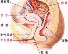 盆腔淤血综合症
