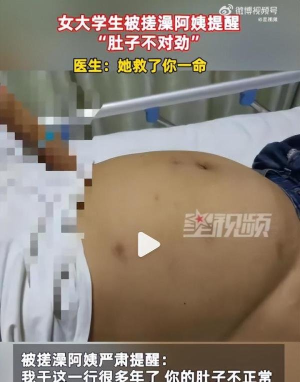 女大学生肚子大被搓澡阿姨救了一命！出现这种情况要注意！