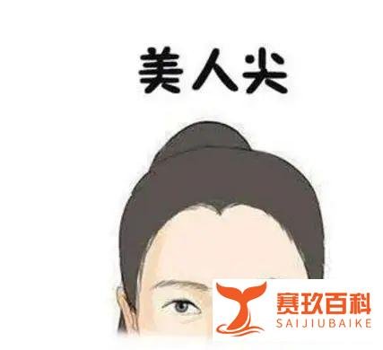 什么是“美人尖”？哪些人不适合做植发手术美人尖？
