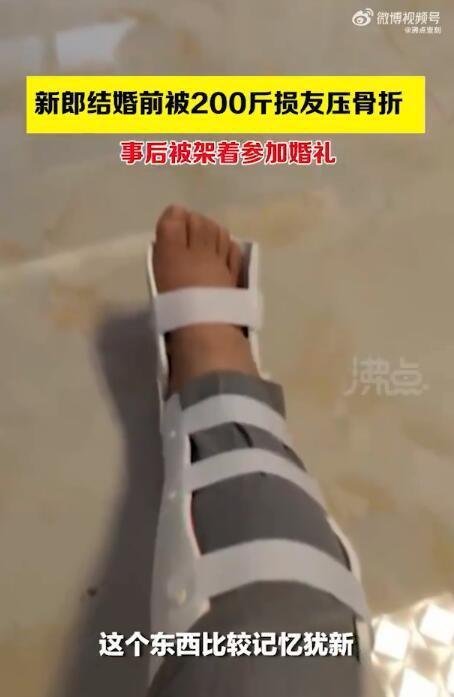 新郎结婚前被200斤朋友闹喜压骨折 这是咋情况?