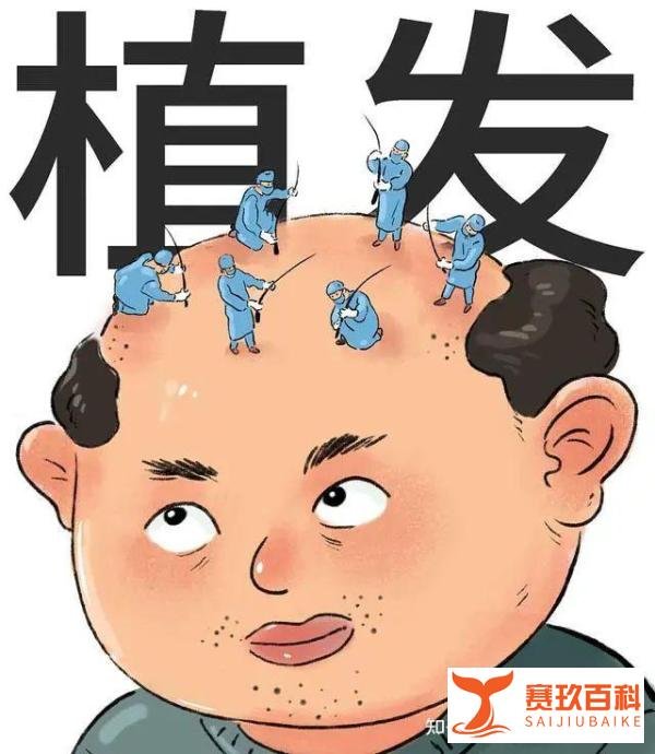 什么是“美人尖”?哪些人不适合做植发手术美人尖?