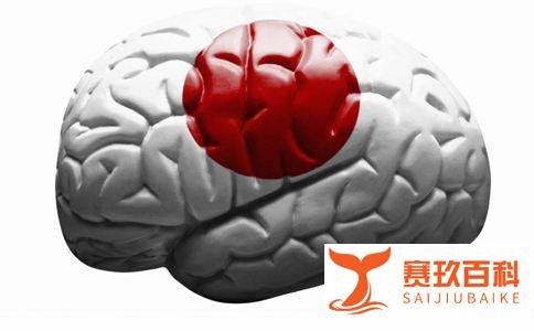 “黑脸医生”胡卫锋逝世，明明是肺炎为什么会死于脑出血？