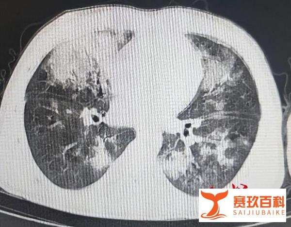 别再当“夜猫子”！长期熬夜打游戏，17岁少年多病齐发健康“大崩盘”