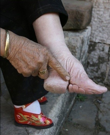 三寸金莲的介绍