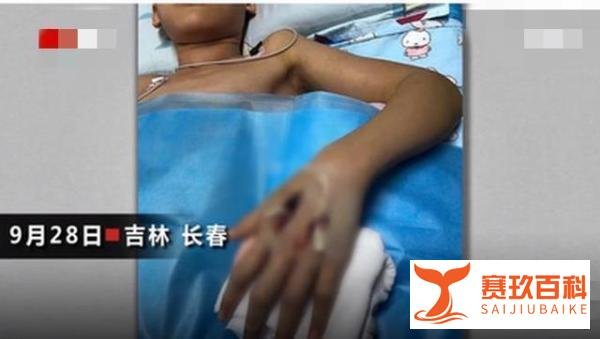 13岁男孩网购，花300元最终赔了10多万，还差点被截肢