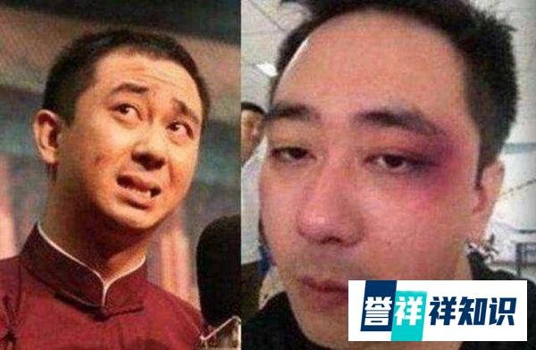 王自健前妻发文否认“家暴女”，打前夫500个耳光，烫6次烟头皆为炒作