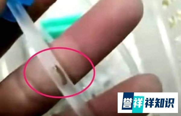 输液管中惊现“虫”吓坏孩子父母