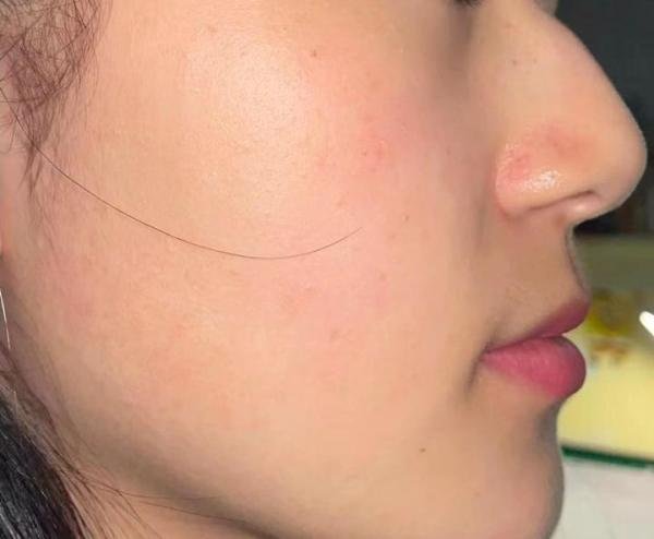 cj小白瓶水乳真的可