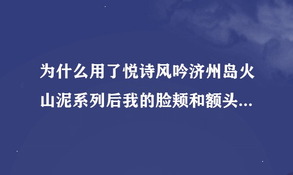 为什么用了悦诗风吟济州岛火山泥系列后我的脸颊和额头会长了那么多的小油粒？