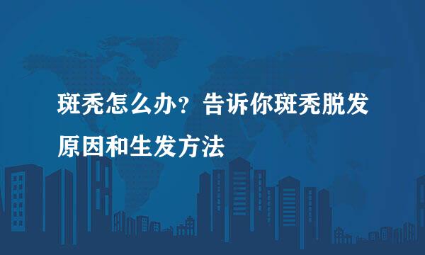 斑秃怎么办?告诉你斑秃脱发原因和生发方法