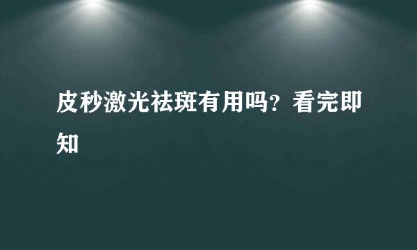 皮秒激光祛斑有用吗?看完即知