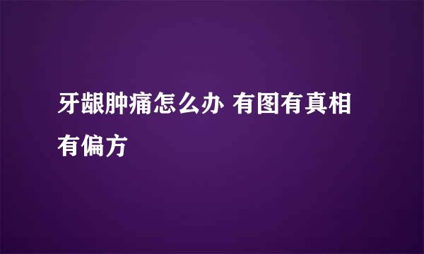 牙龈肿痛怎么办 有图有真相有偏方