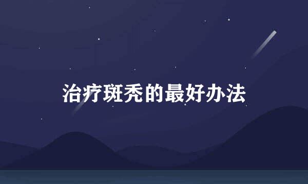 治疗斑秃的最好办法