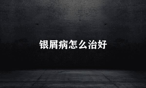 银屑病怎么治好