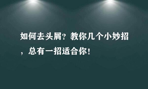 如何去头屑?教你几个小妙招,总有一招适合你!