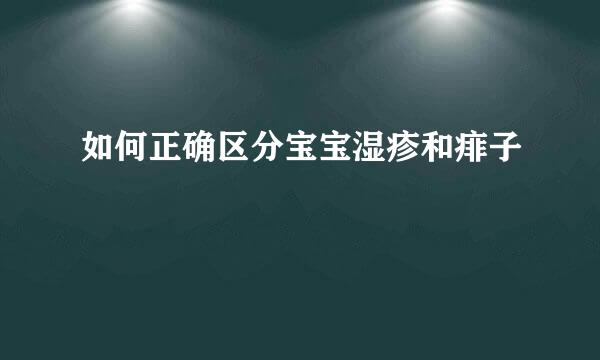 如何正确区分宝宝湿疹和痱子