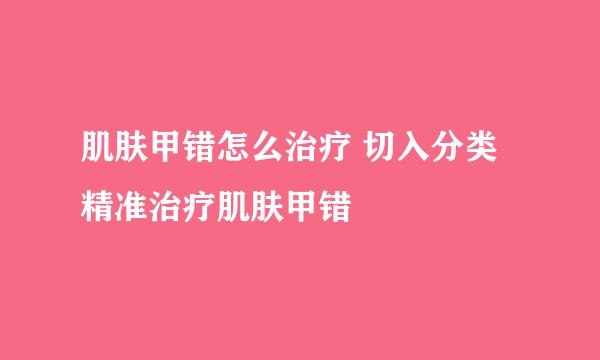 肌肤甲错怎么治疗 切入分类 精准治疗肌肤甲错