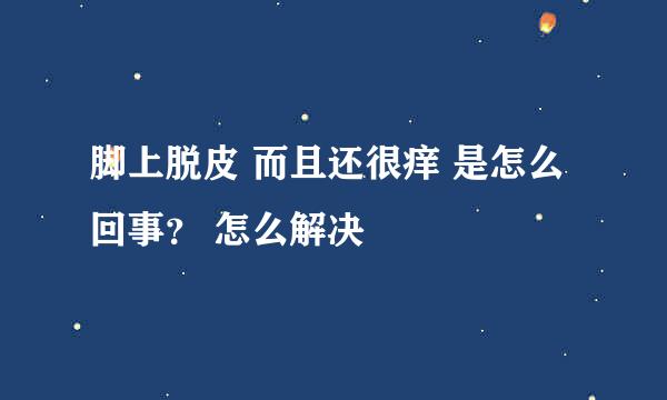 脚上脱皮 而且还很痒 是怎么回事? 怎么解决