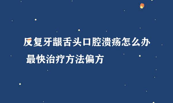 反复牙龈舌头口腔溃疡怎么办 最快治疗方法偏方