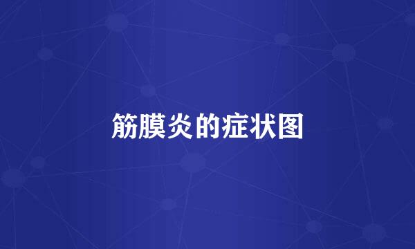 筋膜炎的症状图