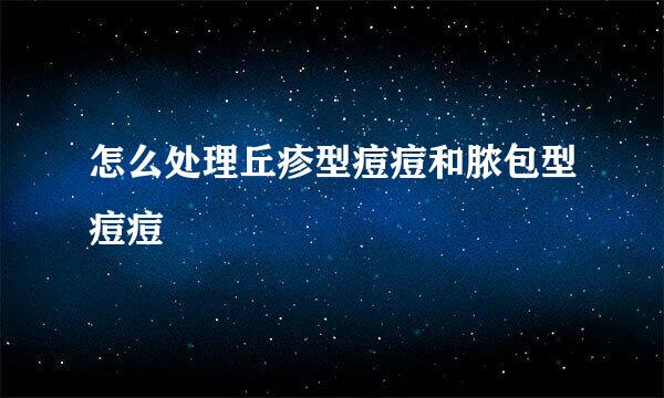 怎么处理丘疹型痘痘和脓包型痘痘